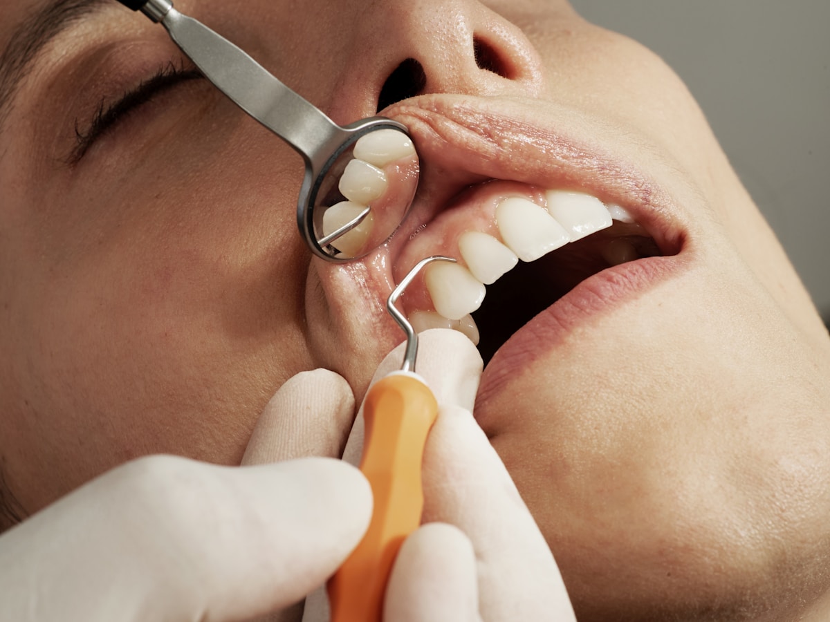 All Dental Services